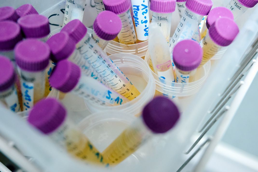 Tiefgefrorene Urinproben liegen in einem Labor des Landesamts für Natur, Umwelt und Verbraucherschutz in NRW im Kühlschrank.