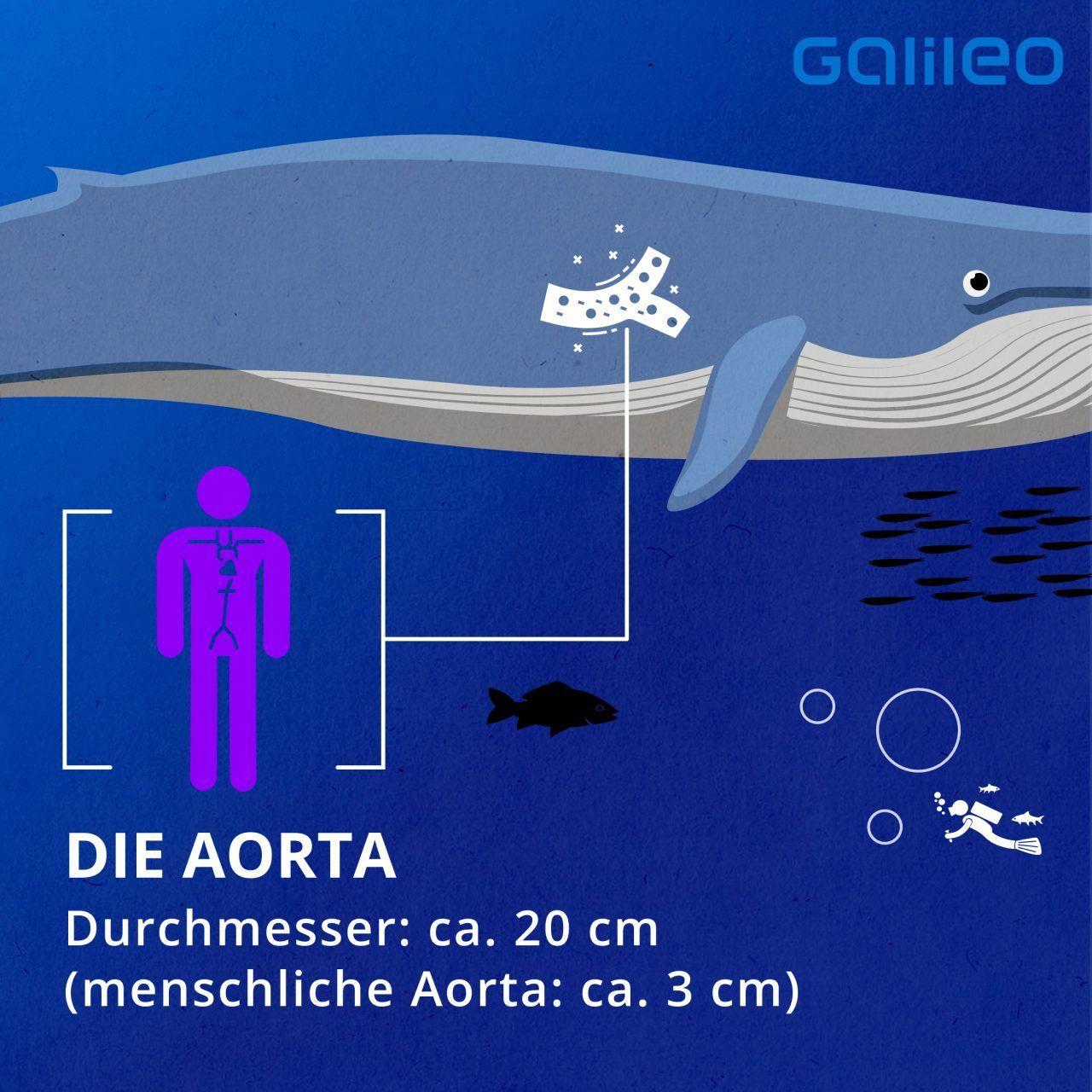 So groß ist die Aorta des Blauwals im Vergleich zu der des Menschen. 