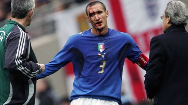 
                <strong>Giorgio Chiellini (Italien)</strong><br>
                Giorgio Chiellini (Italien): Europameister wurde der heutige Juve-Haudegen mit der italienischen U21 trotz zweimaliger Endrunden-Teilnahme in den Jahren 2006 und 2007 nicht. Dennoch wurde aus Chiellini ein Weltstar, der unter anderem mit den Turinern fünf Meistertitel in der Serie A einfuhr. Insgesamt lief er 26 Mal für die italienische U21 auf, dabei gelangen dem Innenverteidiger immerhin sechs Treffer.
              