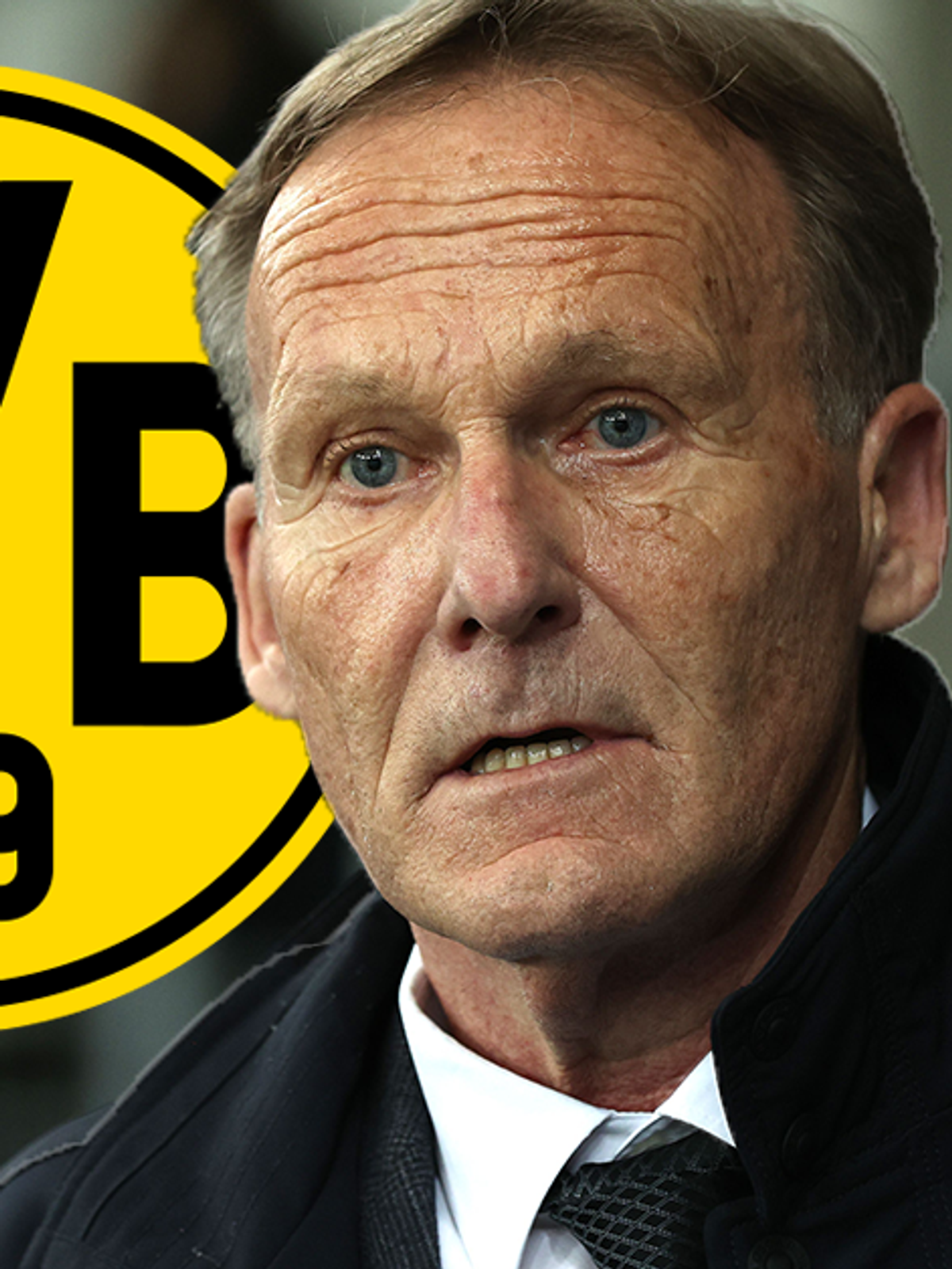 Watzke