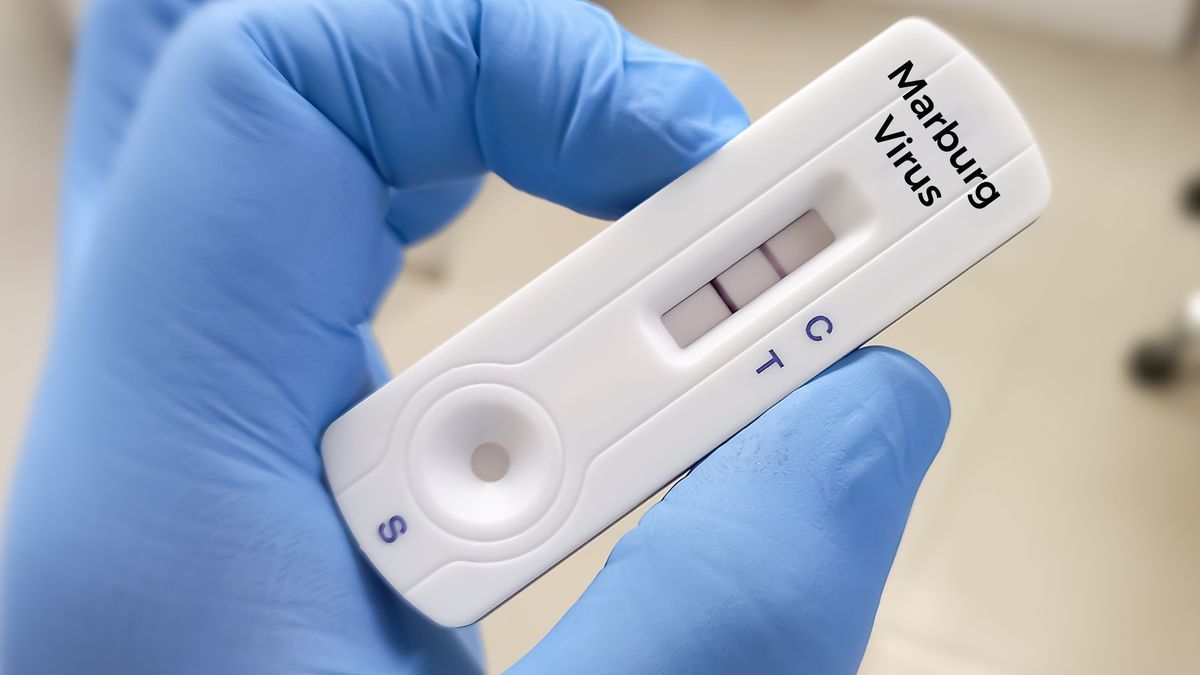 Rapid test device for the Marburg virus test. Medicine and health concept. Marburg haemorrhagic fever.