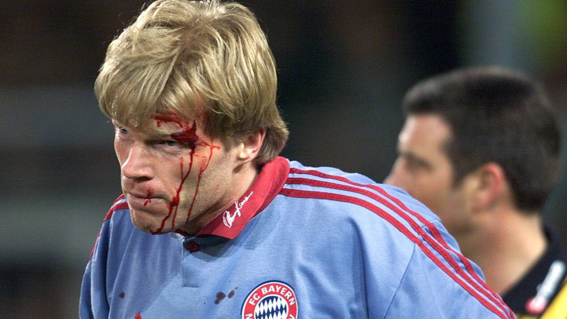 
                <strong>Borussia Mönchengladbach vs. Karlsruher SC 1993/94 (im Bild Oliver Kahn im Trikot des FC Bayern)</strong><br>
                Als Oliver Kahn 2000 in Freiburg von einem Golfball getroffen wurde, konnte das Spiel nach Stillung der Blutung sogar mit Kahn fortgesetzt werden. Etwas anders gestalteten sich die Ereignisse ein paar Jahre zuvor, als der heutige FCB-Vorstand noch das Tor in Karlsruhe hütete. Kurz nach der Pause im Sechzehntelfinale des DFB-Pokals in der Saison 1993/1994 traf eine Kastanie den damaligen KSC-Torhüter am Kopf. Nach Aussagen seines Präsidenten war Kahn anschließend "nicht mehr im Vollbesitz seiner Kräfte". Der spätere Welttorhüter flog nach einer Notbremse in der 85. Minute vom Platz, für den KSC eine Folge des Kopftreffers. Karlsruhe hatte bereits dreimal gewechselt, weshalb Feldspieler Rainer Schütterle ins Tor musste. Mit neun Mann rettete sich der KSC beim Stand von 3:3, verlor aber nach Verlängerung deutlich mit 5:3. Der KSC legte gegen die Wertung des Spiels Protest ein. Nach einem langen Rechtsstreit kam es schließlich zur Wiederholung auf neutralem Boden. Gladbach siegte mit 1:0 und zog ins Achtelfinale ein.
              