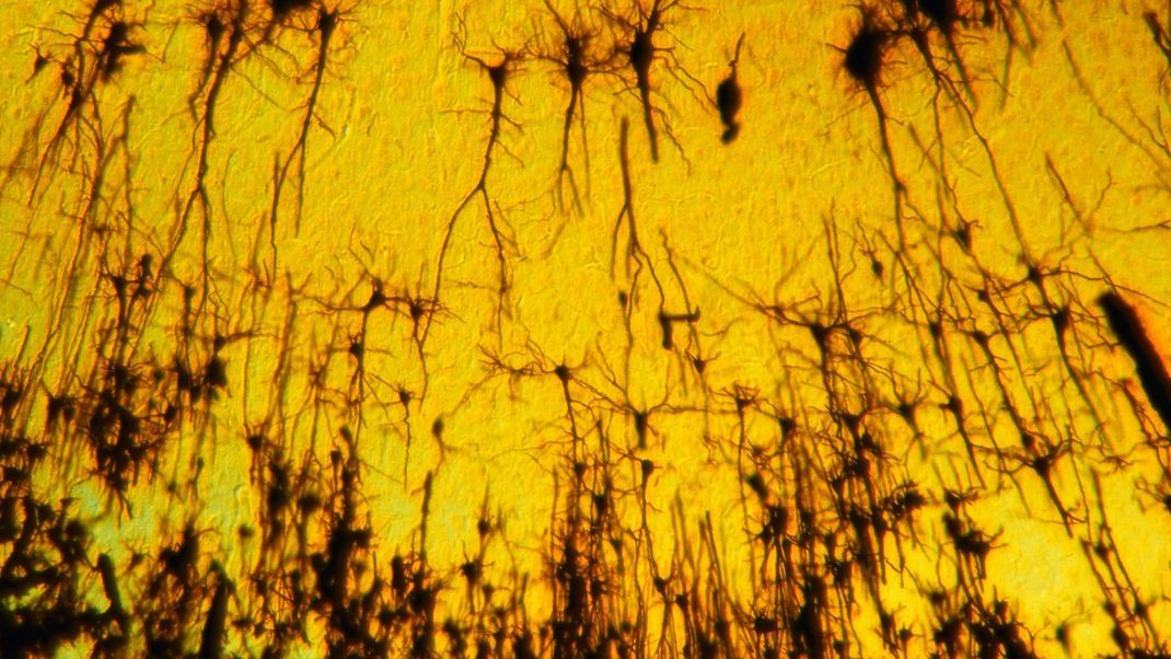 Großhirn: Die Nervenzellen in der Großhirnrinde helfen beim Speichern von Erinnerungen. Das Foto zeigt eine Mikroaufnahme in der Vergrößerung 100:1. Die Erinnerungen legen dabei einen unterschiedlichen Weg durch verschiedene Teile des Gehirns zurück. 