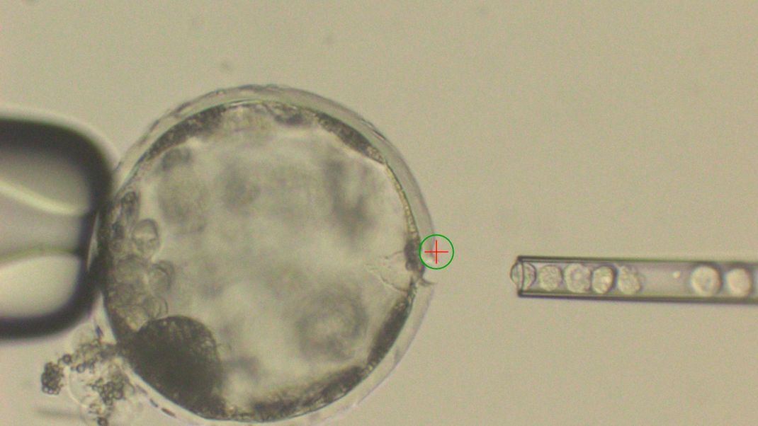 Bei einem Chimären-Experiment werden menschliche Stammzellen in einen frühen Schweine-Embryo injiziert. 