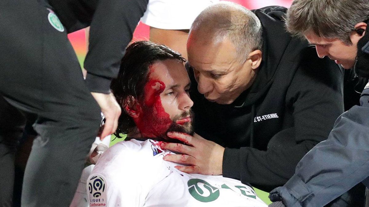 Subotic bei Zusammenprall mit Keeper schwer verletzt