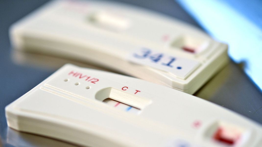 Diagnose HIV