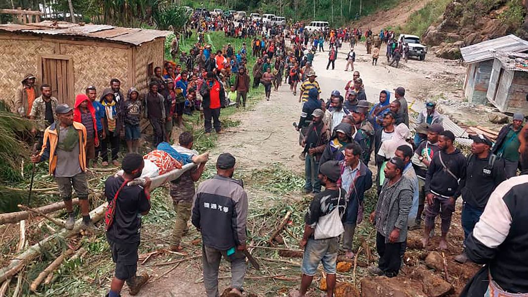 Auf diesem von der Internationalen Organisation für Migration zur Verfügung gestellten Foto wird eine verletzte Person nach einem Erdrutsch auf einer Bahre zum Arzt getragen. 