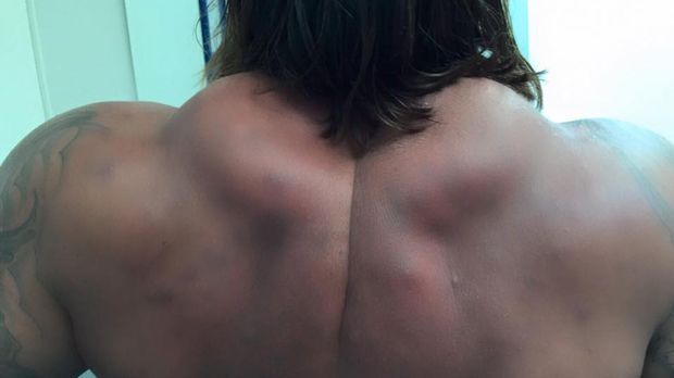 
                <strong>Tim Wiese: Seine Nackenmuskeln</strong><br>
                Das Bild von Tim Wiese ist beeindruckend und erschreckend zu gleich. Scheinbar hat der ehemalige Nationaltorhüter in letzter Zeit kein Nackentraining versäumt. Diese Muskelberge sind schon fast unglaublich.
              