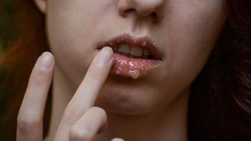 Ein selbsgemachtes Lippen-Peeling geht blitzschnell und hat großen Effekt