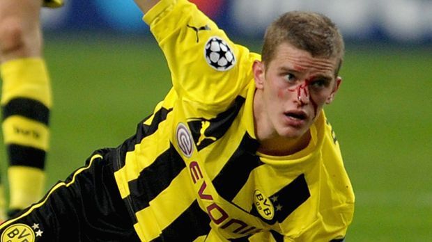 
                <strong>Platz 5: Sven Bender - 136 Spiele</strong><br>
                Platz 5: Sven Bender - 136 Spiele. Ein Blick in die Krankenakte von Bender verrät: Dem Mittelfeldspieler von Borussia Dortmund ist bisher nur wenig erspart geblieben. Von Beschwerden mit dem Sprunggelenk über einen Kieferbruch oder einer Entzündung am Schambein bis hin zu Leistenproblemen. Bender durchlebt alles.
              