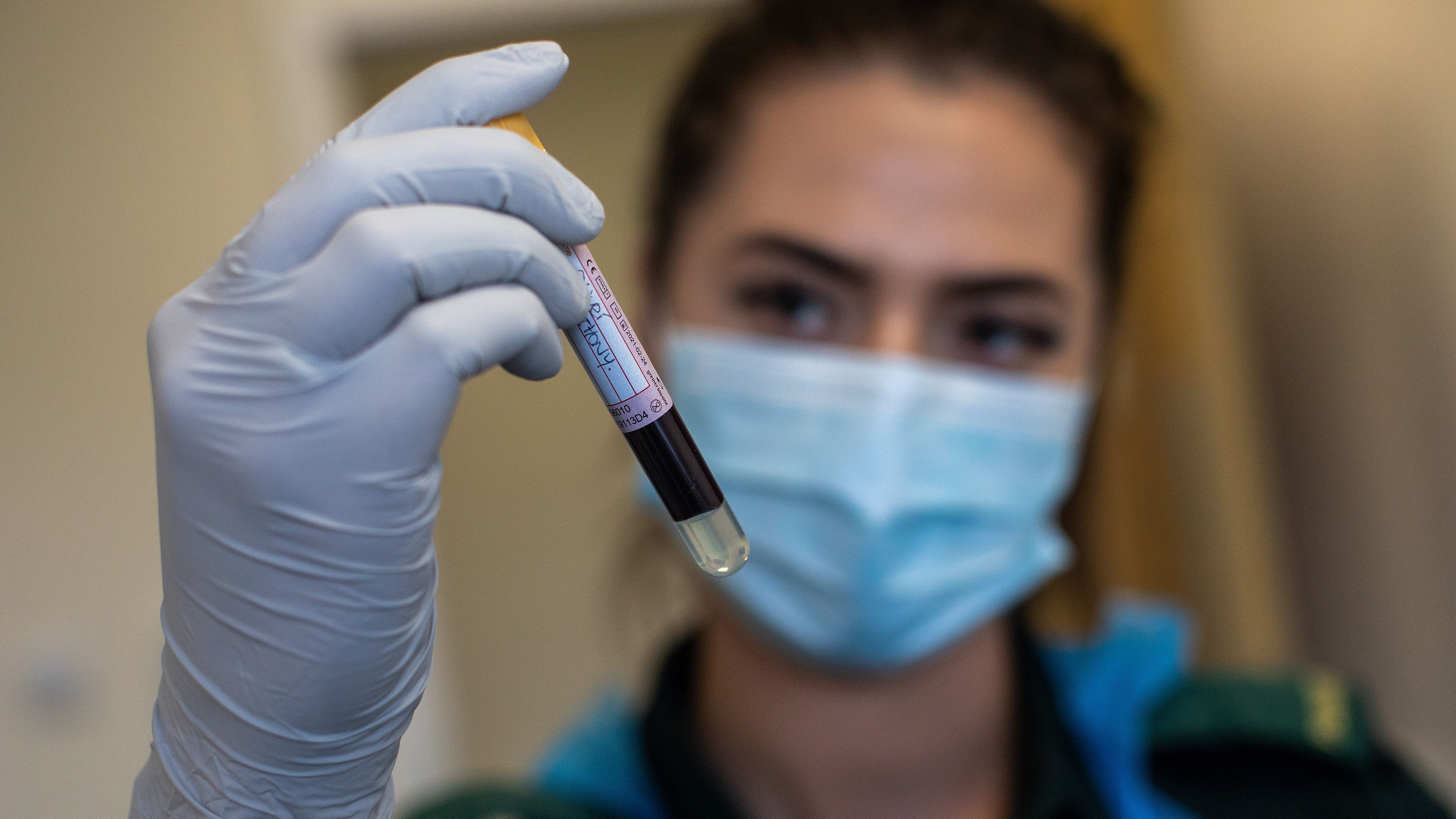 
                <strong>Ablauf der Corona-Tests in den Teameinrichtungen</strong><br>
                Das Unternehmen "BioReference Laboratories" wird die gesamte Erhebung und Analyse der Corona-Tests durchführen, was sowohl Nasenabstrich-Tests auf das Virus, sowie Bluttests auf Antikörper einschließt. Im Fall von positiven Testergebnissen werden Einzelspieler sofort von ihren Team-Mitgliedern isoliert, nach Hause transportiert und dort umgehend unter Quarantäne gestellt. Ein Mitarbeiter mit Symptomen, dessen Test positiv ausfällt, muss die Mannschaftseinrichtung mindestens zehn Tage lang meiden, darf weder reisen noch direkten Kontakt zu Spielern oder Klubmitarbeitern mit Ausnahme des medizinischen Personals haben. Zudem kann der Mitarbeiter erst zurückkehren, wenn 72 Stunden seit dem letzten Auftreten der Symptome vergangen sind und dies vom Mannschaftsarzt abgesegnet wurde. Eine Person ohne Symptome mit einem positiven Test muss zehn oder mindestens fünf Tage seit dem ersten positiven Test vom Team fernbleiben. Und nach zwei aufeinander folgenden negativen Befunden müssen mindestens 24 Stunden dazwischen liegen.
              