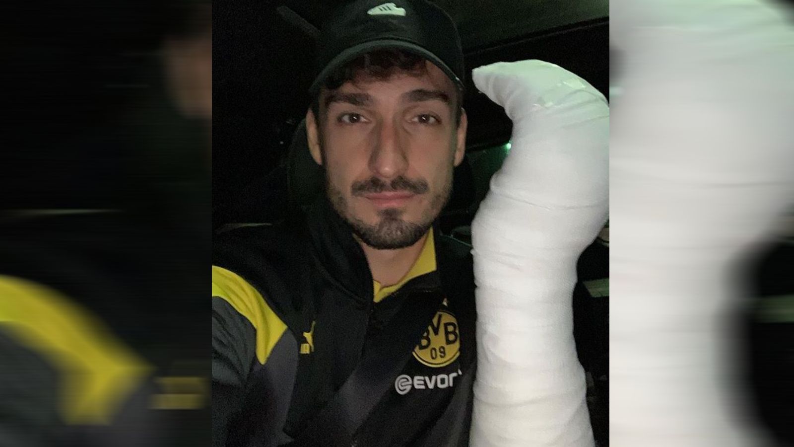 
                <strong>Mats Hummels </strong><br>
                Nicht nur die Geschenke, sondern auch die linke Hand sind bei Mats Hummels am diesjährigen Weihnachtsfest eingepackt. Es sind die Folgen eines Sturzes im letzten Saisonspiel bei der TSG Hoffenheim.
              