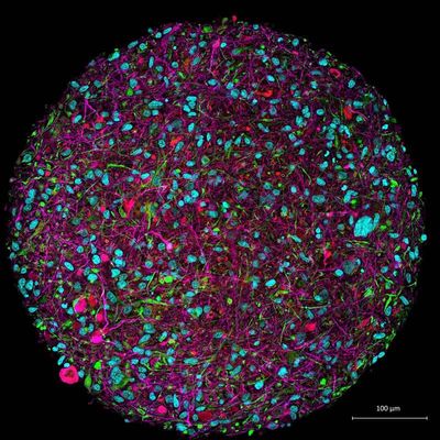 Organoide Intelligenz - Ein Computerprozessor aus Gehirnzellen