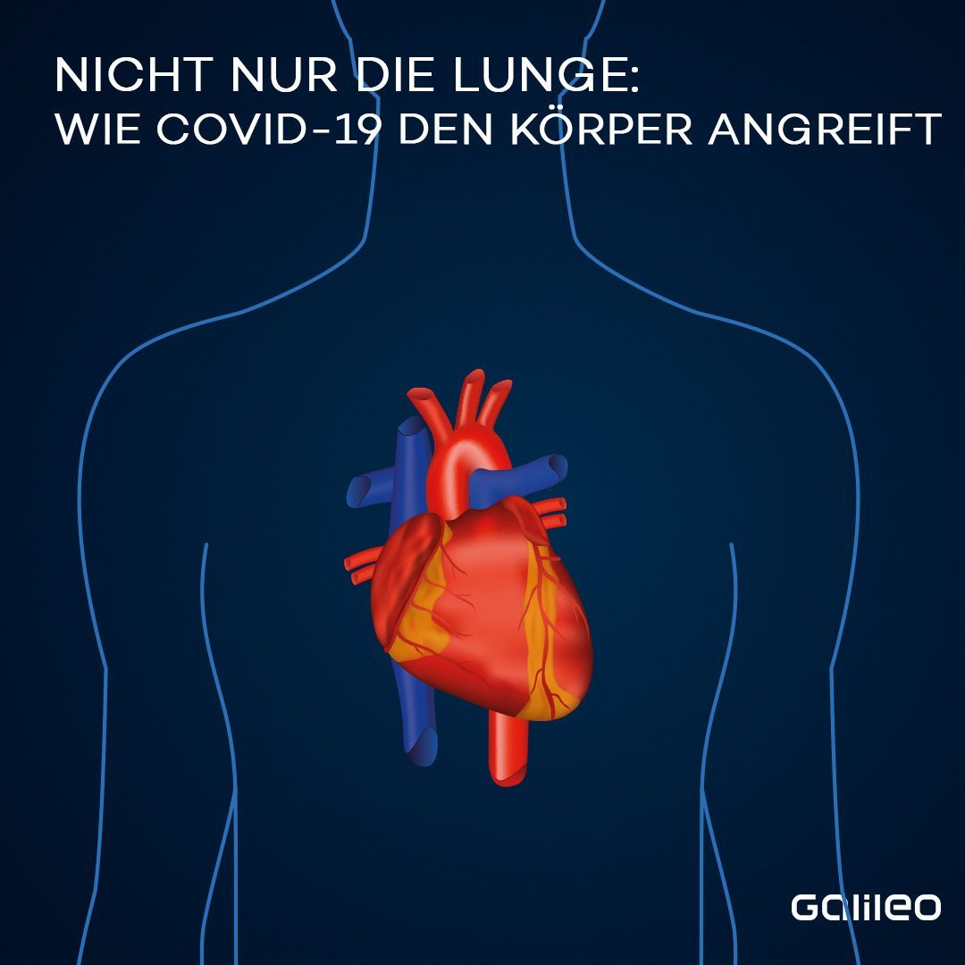 Die Infektion kann sich auch im Herz-Kreislauf-System ausbreiten. Die Gefäße verengen sich und werden schlechter durchblutet. Thrombosen, Embolien oder Herzinfarkte sind mögliche Folgen. 