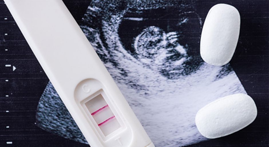 Schwangerschaftsabbruch, Abtreibung