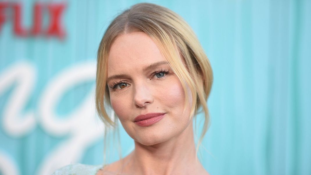 Besonderes Merkmal: Zwei unterschiedliche Augenfarben faszinieren das Gegenüber meist, weil eine Heterochromie so selten ist. Auch Schauspielerin Kate Bosworth, bekannt aus „Superman Returns“ oder „Still Alice“, besitzt in ihrem rechten Auge neben der blauen Farbe einen braunen Sprenkel.