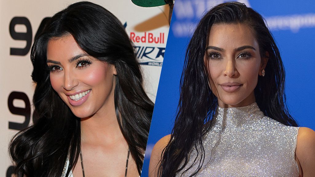 Alles echt? Kim Kardashian streitet Beauty-OPs ab, nur zu ihren Botox-Behandlungen steht sie.