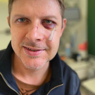 Matthias Ecke hat sich nach dem Überfall in Dresden aus dem Krankenhaus gemeldet. Die Anteilnahme und Solidarität gebe ihm Kraft, schrieb er am 6. Mai in einem Beitrag auf X.