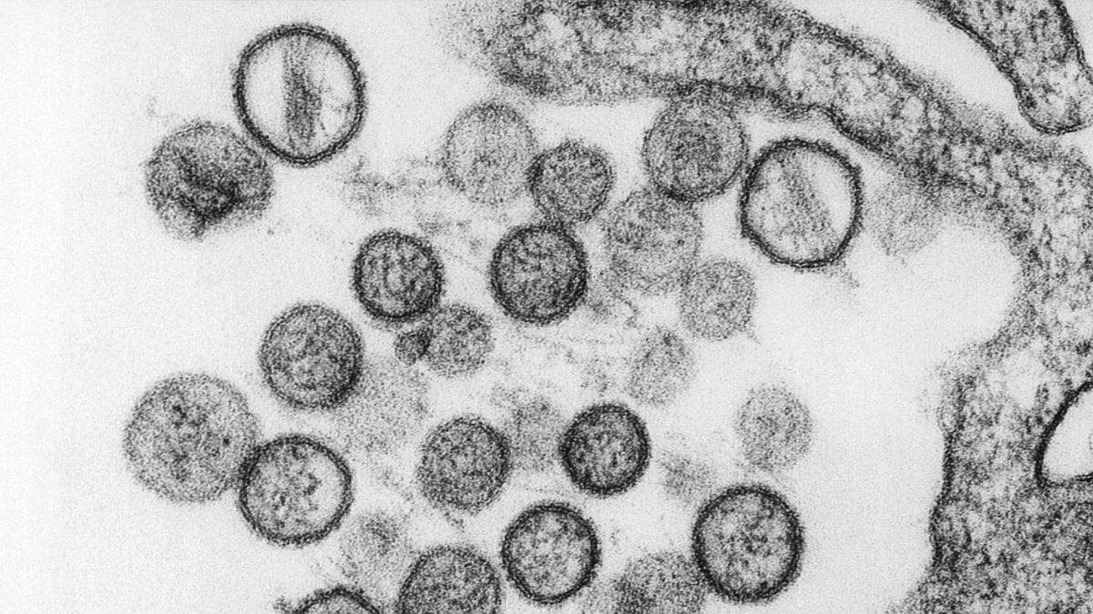 WASHINGTON-HANTAVIRUS/