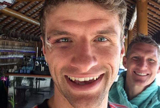 
                <strong>Dank an die Fans!</strong><br>
                Thomas Müller kann wieder lachen und twittert: "Danke für die vielen Genesungswünsche. Alles gut bei mir, auch wenn ich wie ein wenig wie ein Boxer aussehe."
              