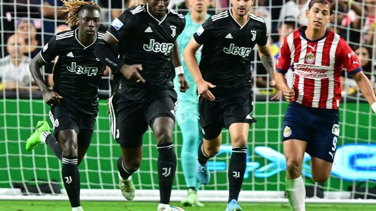Paul Pogba (2.v.l.) muss doch nicht unters Messer