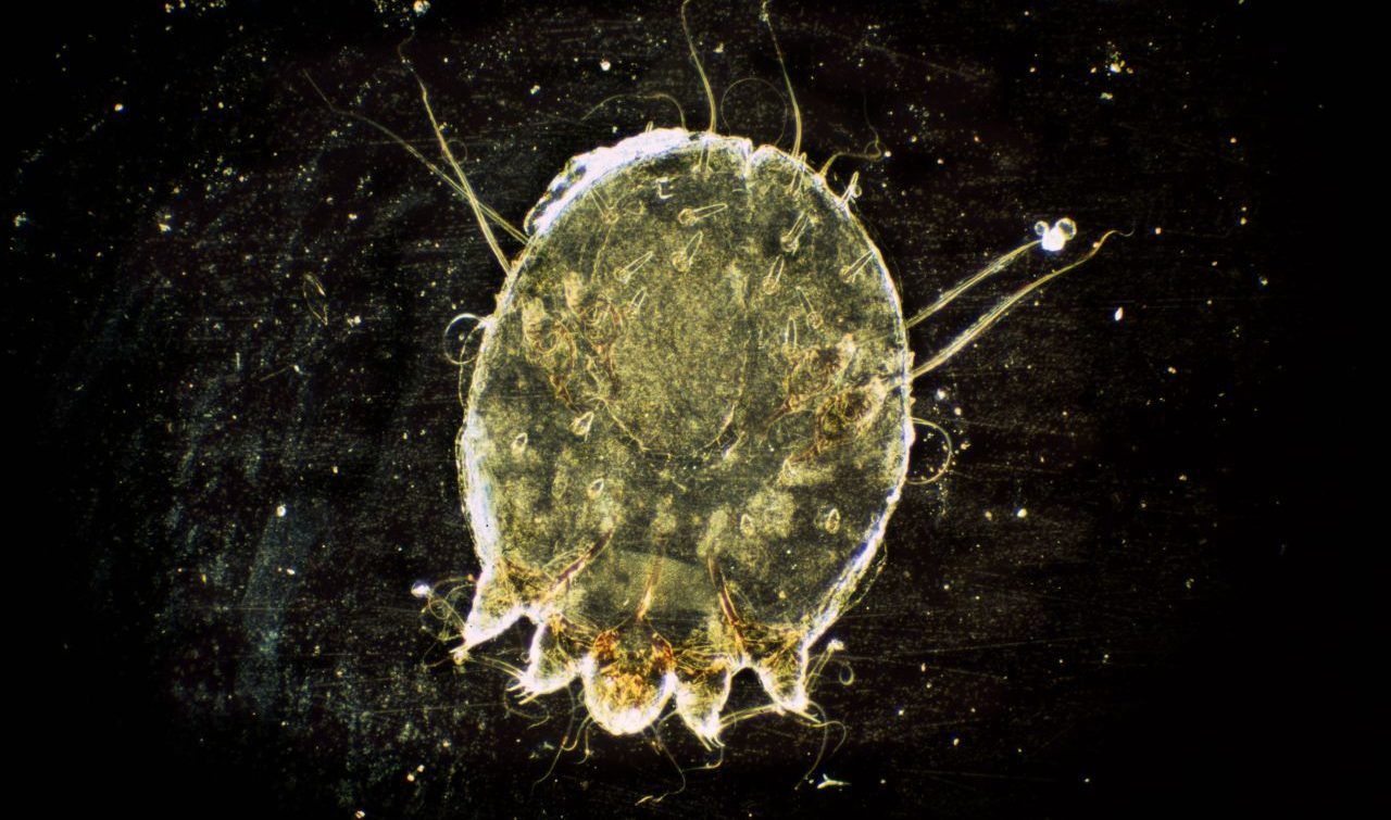 Krätzmilben sind nur einen halben Millimeter groß und mit bloßem Auge kaum zu erkennen. Die Parasiten gehören wie auch Zecken zu den Spinnentieren. 