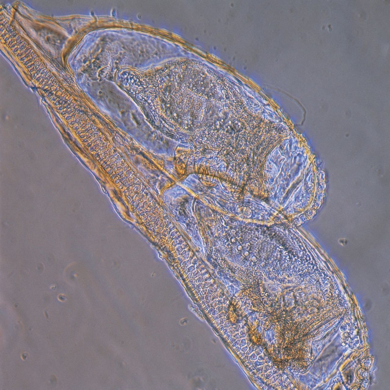 Die etwa einen Millimeter großen Eier der Kopflaus sind ungefähr das kleinste, was das menschliche Auge sehen kann.