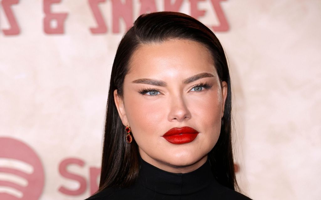 Schönheits-OP missglückt? Supermodel Adriana Lima klärt auf