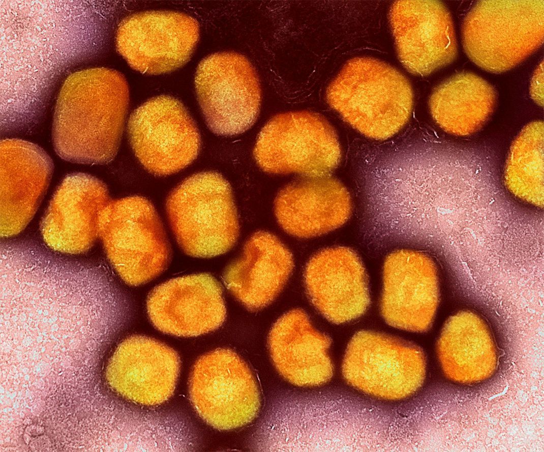 In Deutschland ist zum zweiten Mal die neue Variante des Mpox-Virus nachgewiesen worden. (Archivbild)