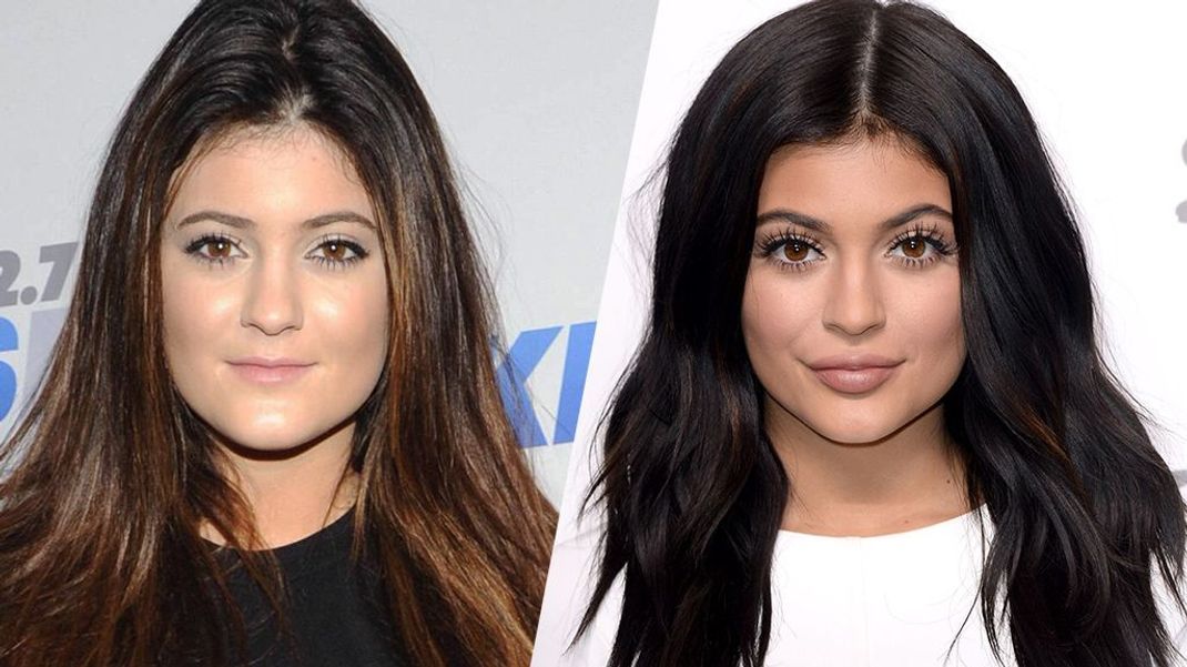 Die Verwandlung: Kylie Jenners Schönheitsoptimierungen sind ersichtlich.
