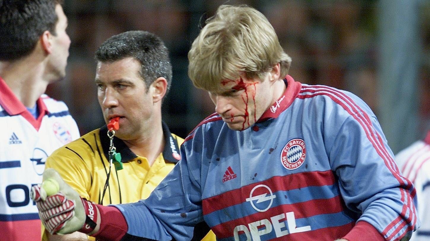 <strong>Oliver Kahn: Bundesliga 2000, SC Freiburg - FC Bayern München</strong><br>Der ehemalige Torwart Oliver Kahn erlitt durch einen Golfball, der aus dem Publikum geworfen wurde, eine Platzwunde am Kopf. Kahn hat in seiner rechten Hand den Golfball, von dem er am Kopf getroffen wurde.&nbsp;