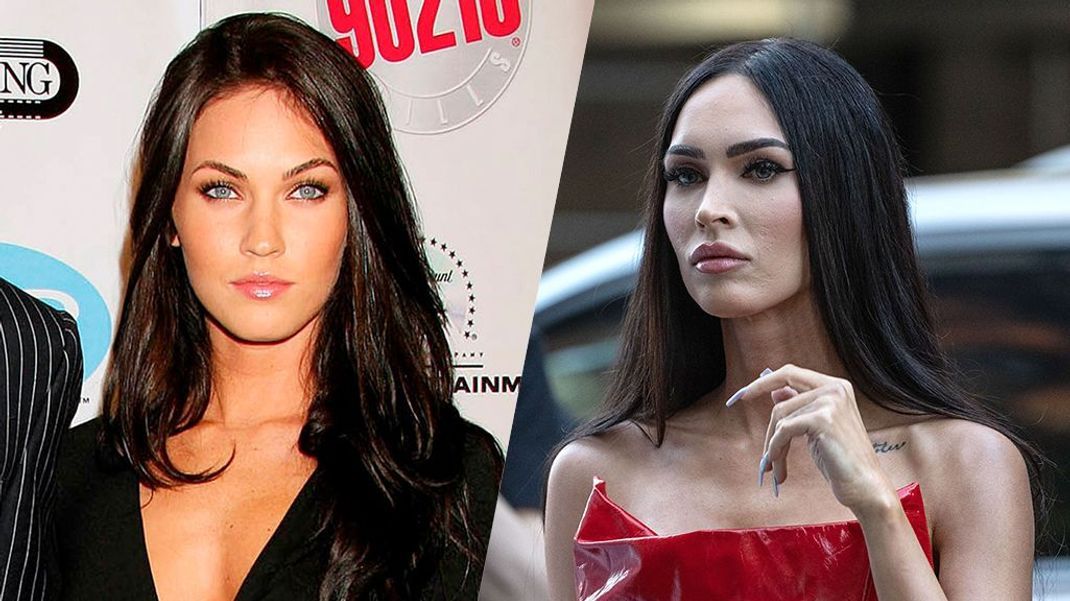 Nase, Wangenknochen, Lippen: Megan Fox hat sich optisch ein wenig verändert.