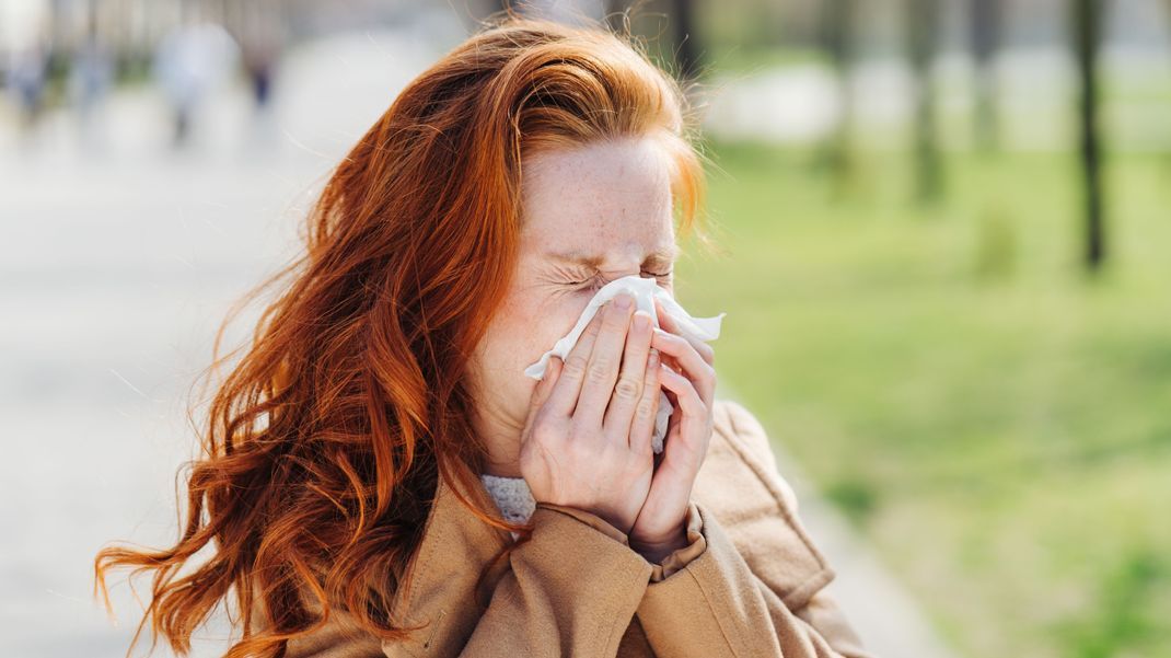 Du musst im Frühling oft niesen und deine Augen brennen? Wir klären, welche Symptome auf eine Allergie schließen lassen. 
