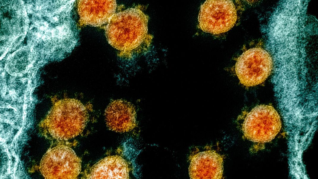 WHO drängt Peking zu mehr Studien über den Ursprung des Coronavirus. China blockiert.