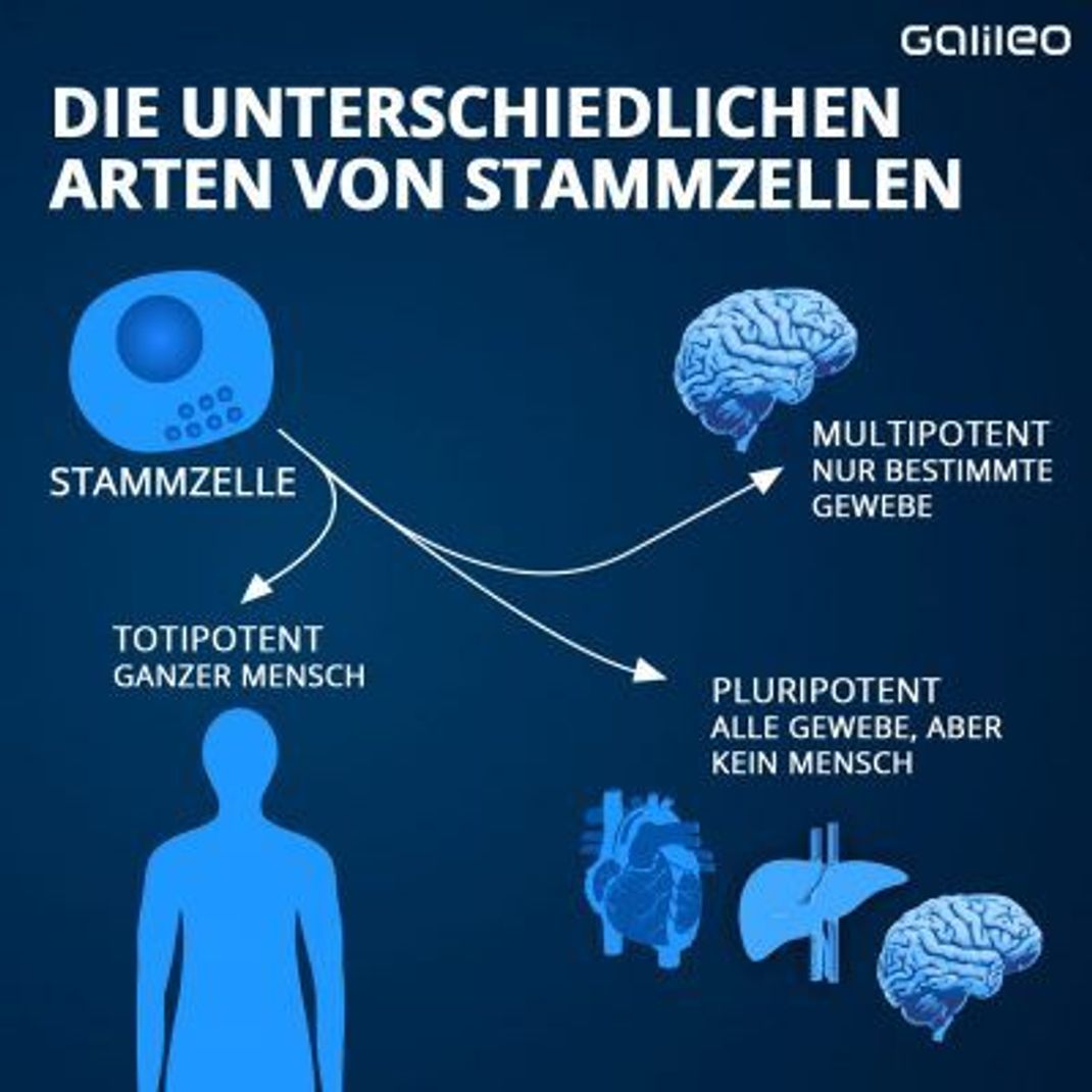 Es gibt unterschiedliche Arten von Stammzellen: totipotente, pluripotente und multipotente.