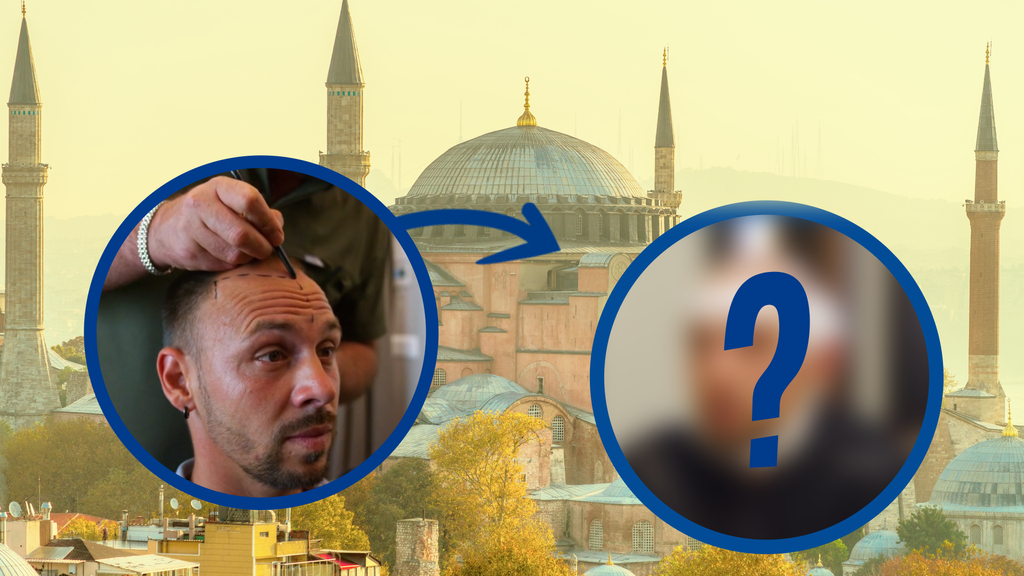 Volles Haar & kleinere Nase: Warum ist die Türkei so gefragt bei Beauty-OPs?