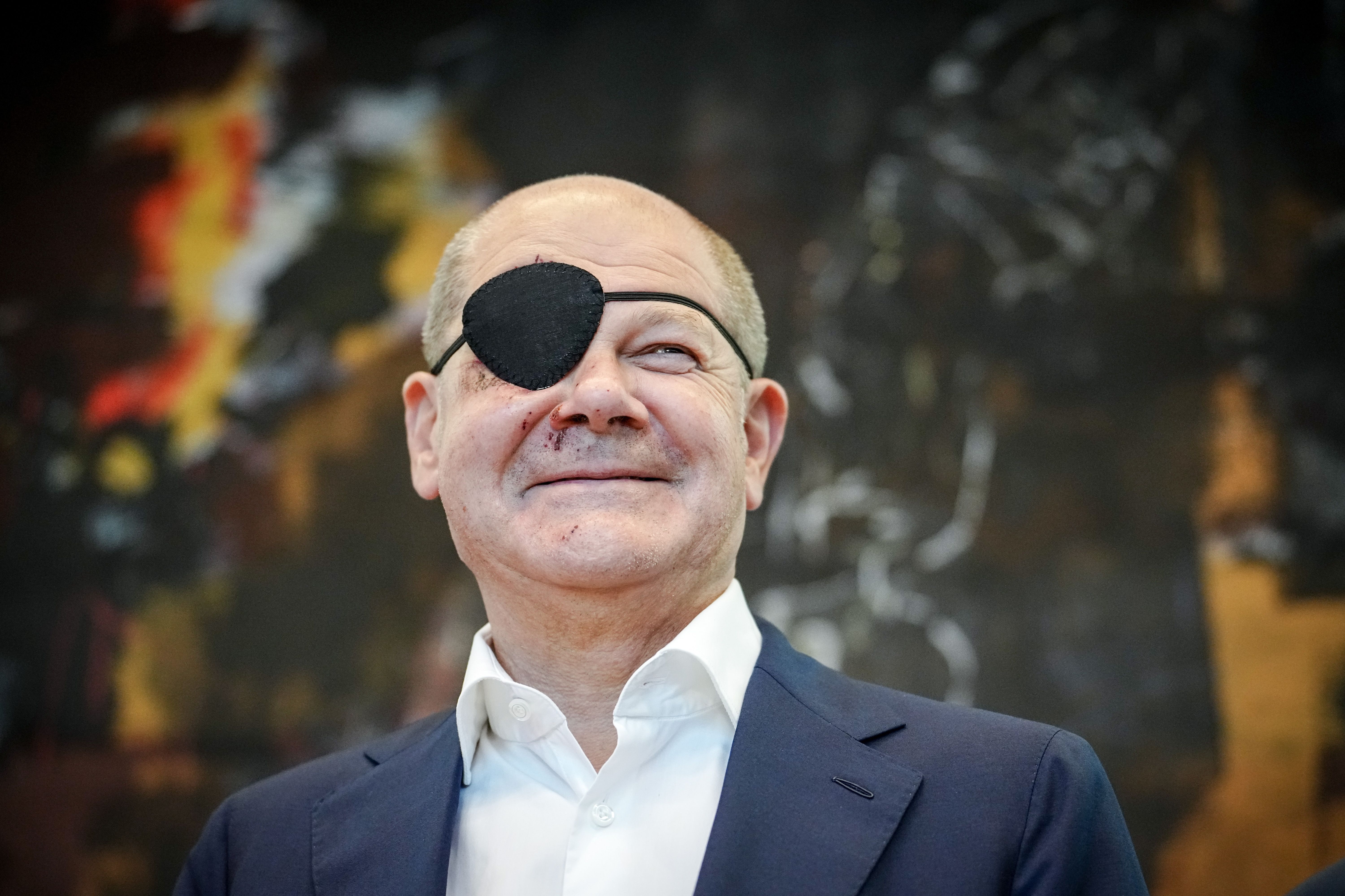 4. September 2023: Nach einem Sportunfall muss Bundeskanzler Olaf Scholz (SPD) einige Tage eine Augenklappe tragen.