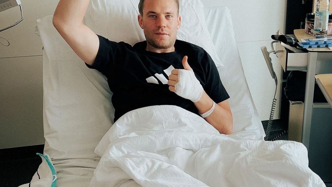 Fußball-Nationaltorhüter Manuel Neuer liegt nach einem Skiunfall mit gebrochenem Unterschenkel im Krankenhaus.

