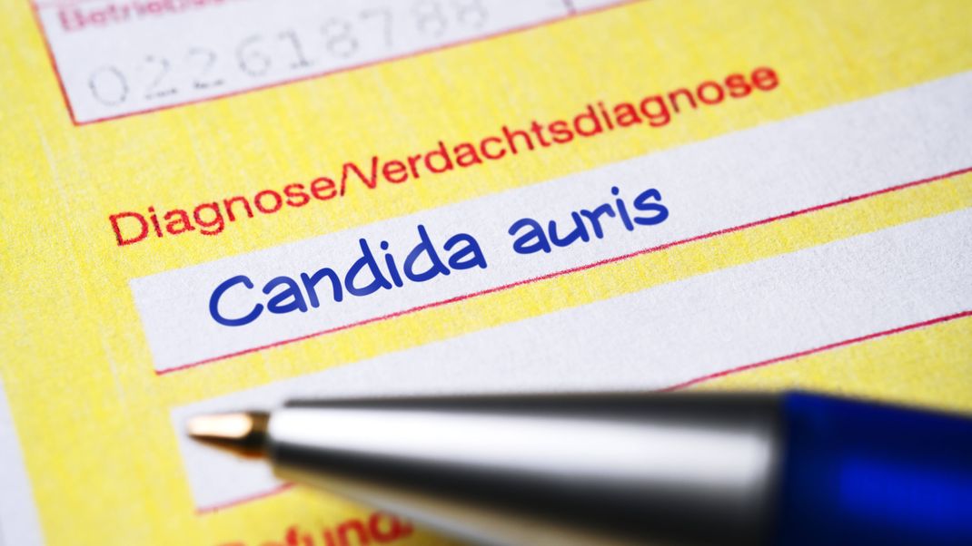 Candida auris