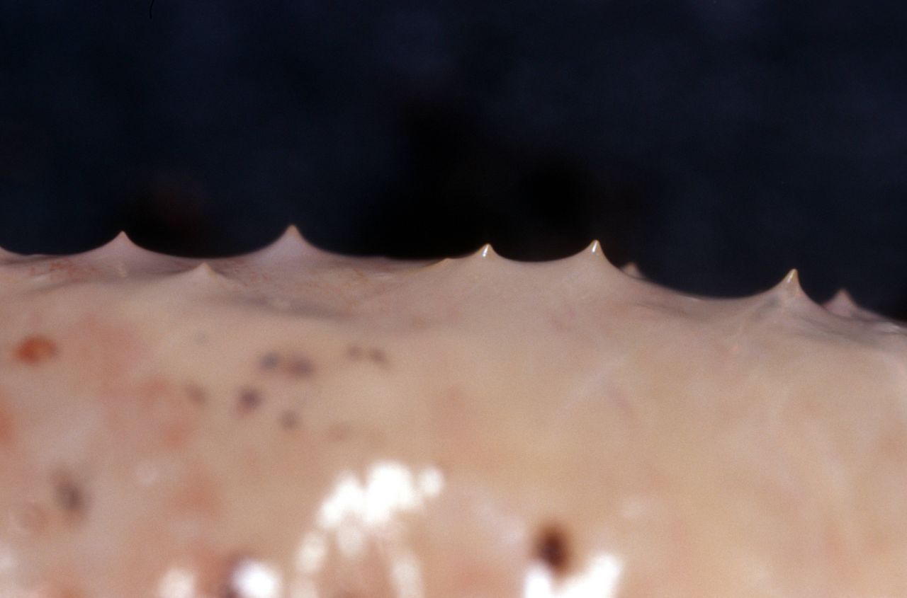 Von wegen aalglatt: Regenwürmer haben Borsten auf der Haut. Die brauchen sie zur Fortpflanzung.