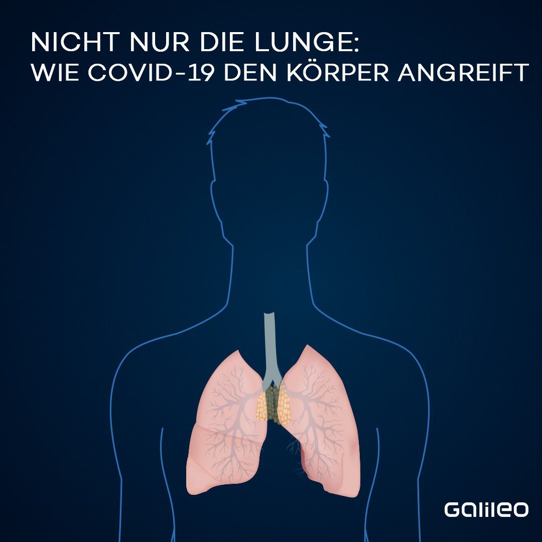 Die Lunge ist meist zuerst betroffen. Immunzellen und totes Gewebe lagern sich an den Lungenbläschen an, die Schäden sind wie Vernarbungen. Häufig kommt es zu einer Lungenentzündung.