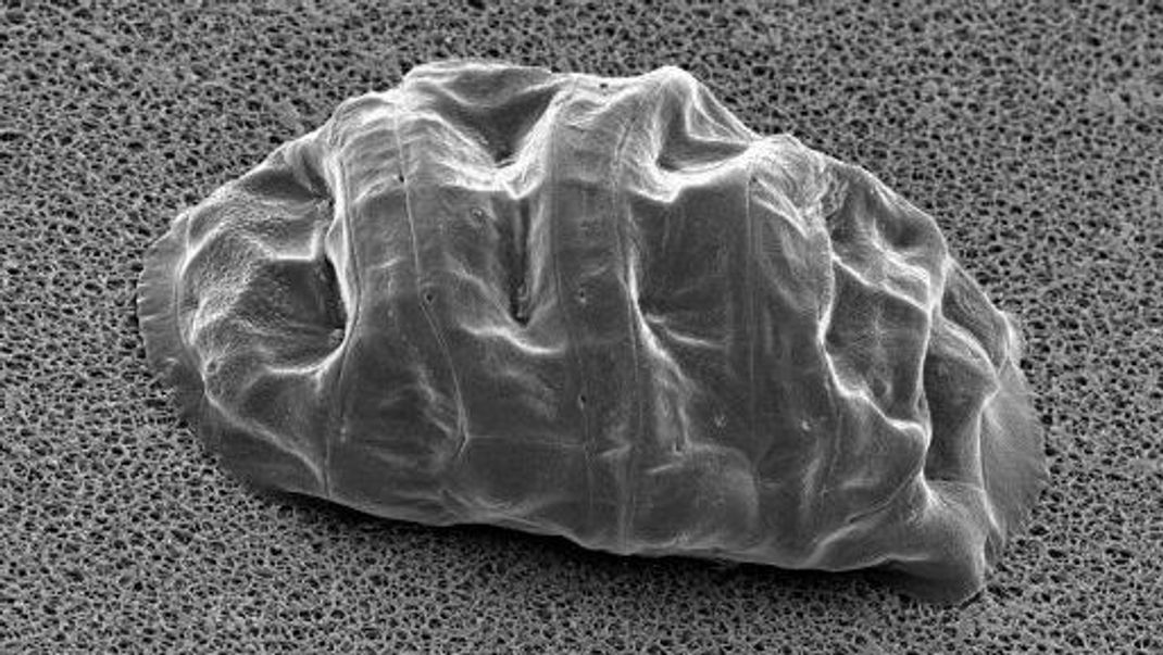 Dieses Mikroskop-Bild zeigt ein Bärtierchen in der Kryptobiose. Dieser todesähnliche Zustand erlaubt es den Wesen, sogar im Weltall zu überleben.