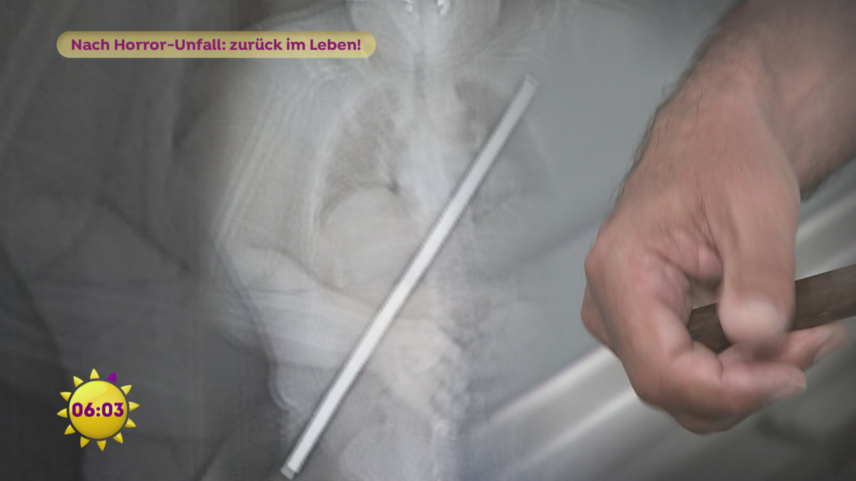 Nach Horror-Unfall: zurück im Leben!