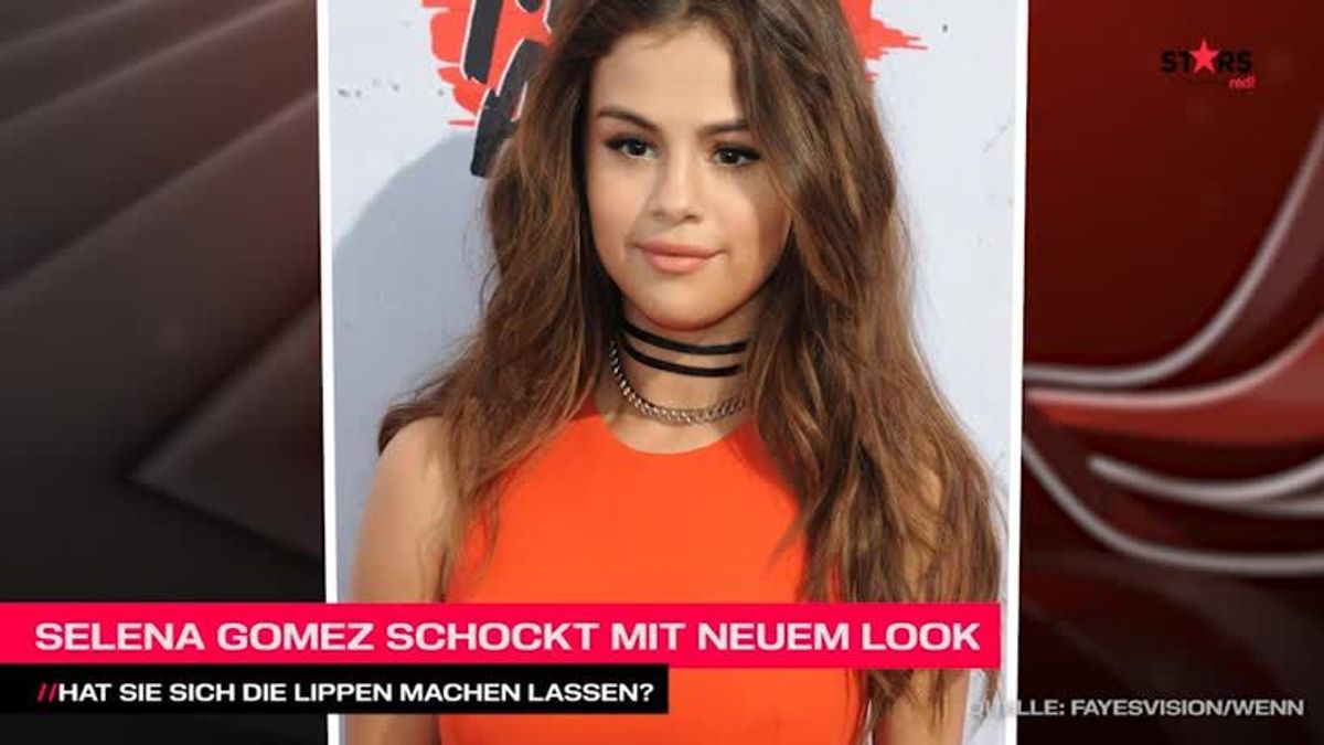 Hatte Selena Gomez eine Beauty-OP?