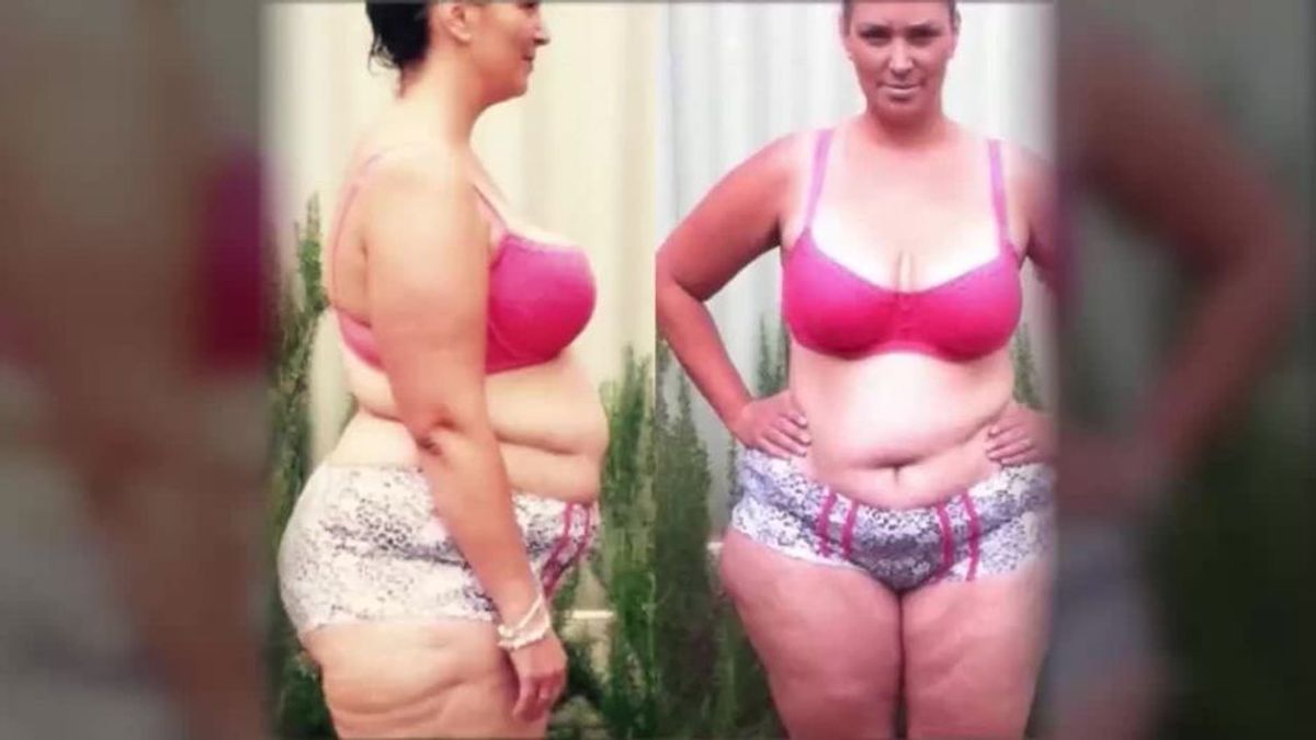 Diese Frau nahm 70 Kilo ab - weil sie auf 4 Lebensmittel verzichtete