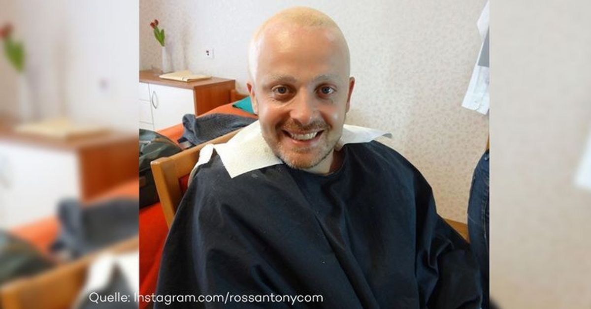 Hat Ross Antony jetzt eine Glatze?