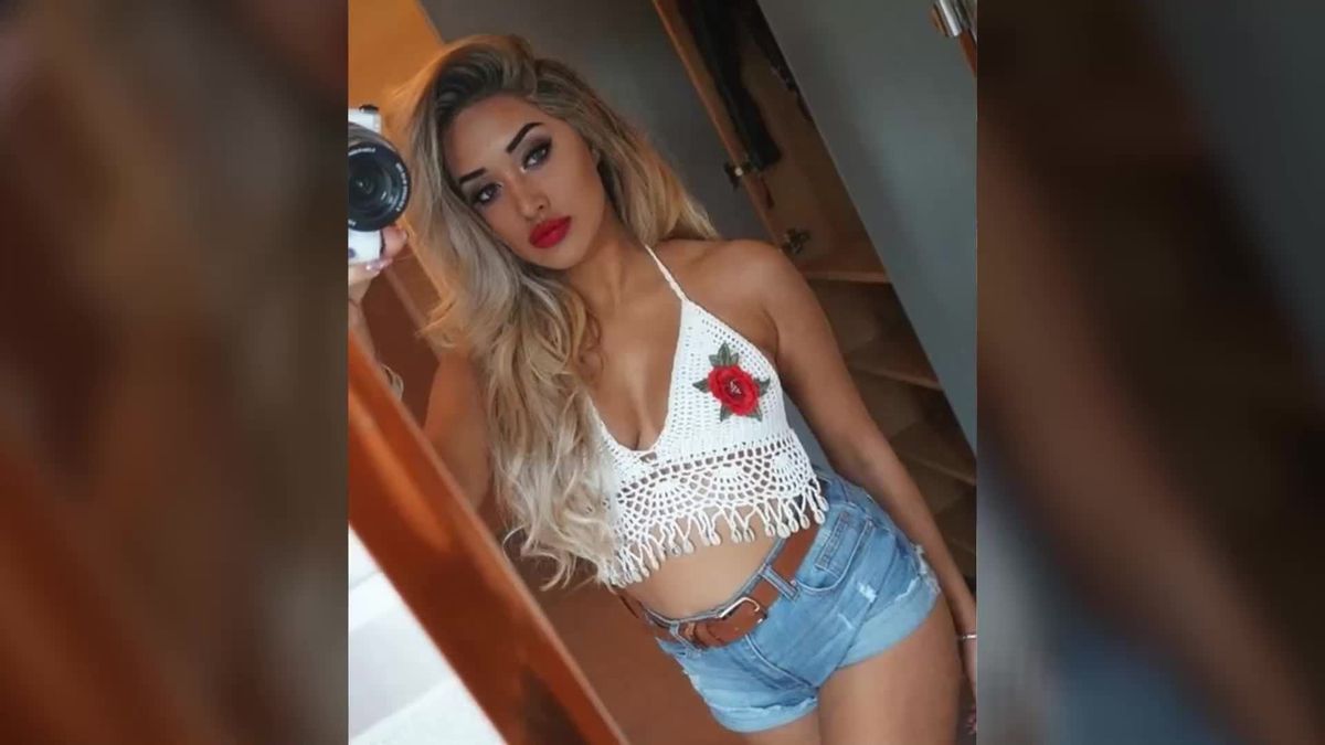 Horror! "Geordie Shore"-Star Zahida Allen platzt die aufgespritzte Lippe