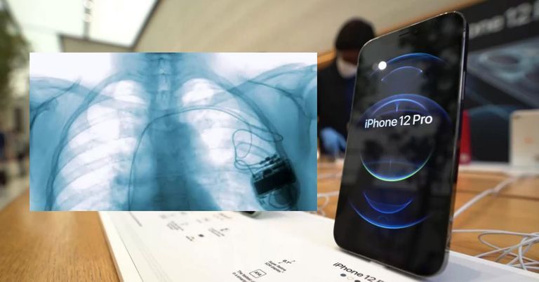 iPhone: Gefahr für Herzschrittmacher - so warnt Apple davor