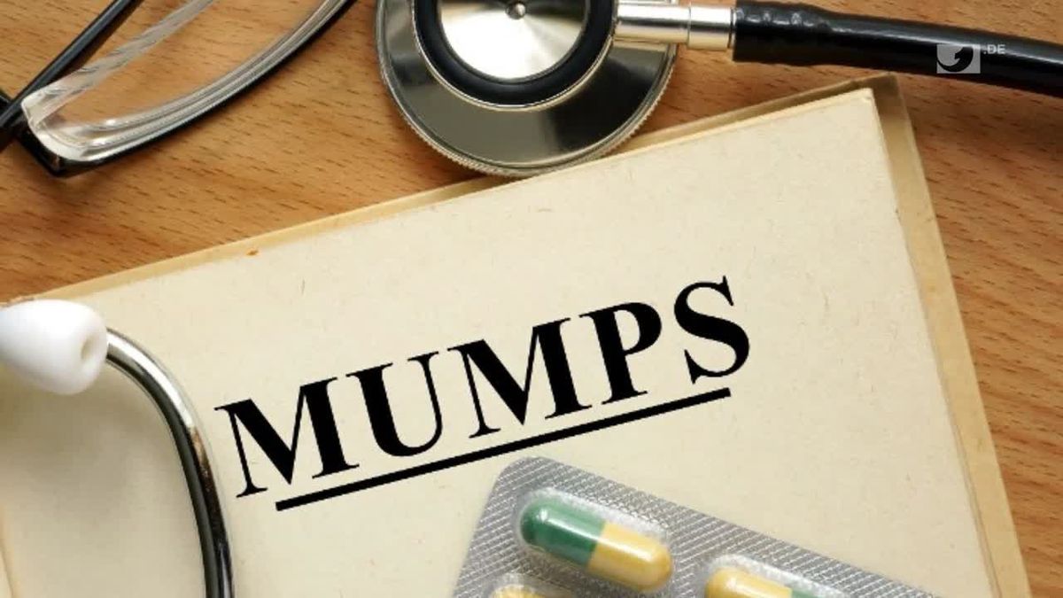 Mumps breitet sich rasend schnell in Deutschland aus - das müsst ihr jetzt wissen