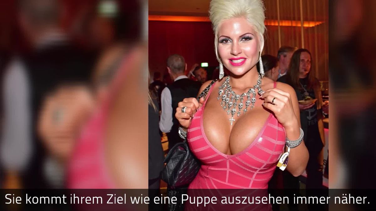 Sophia Wollersheim zeigt sich nach Rippen-OP ohne Korsage - und das ist das Ergebnis